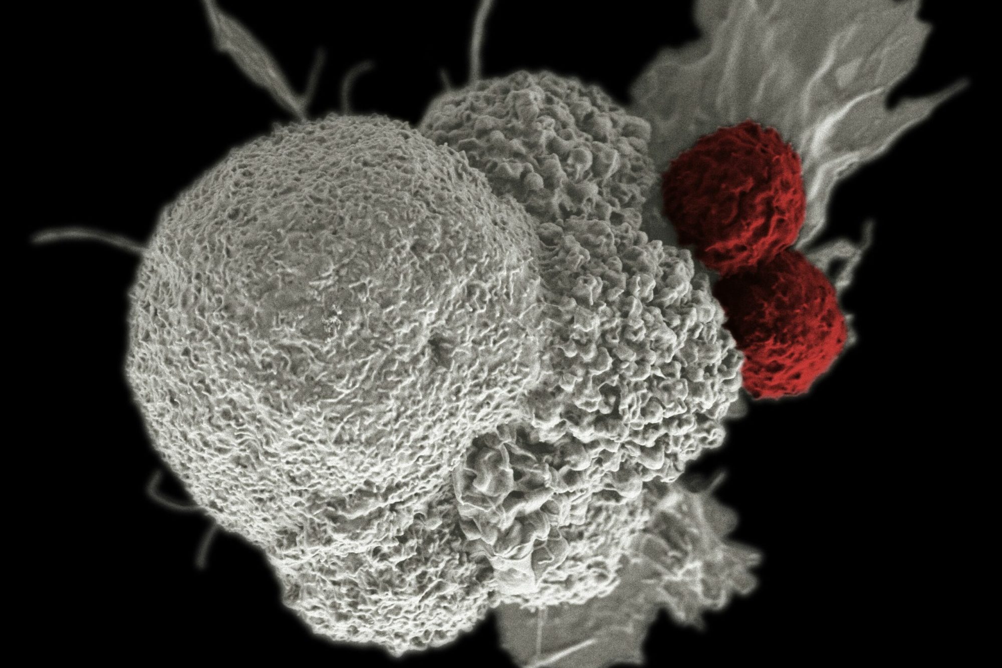 national-cancer-institute-kWAPbD_zaEU-unsplash